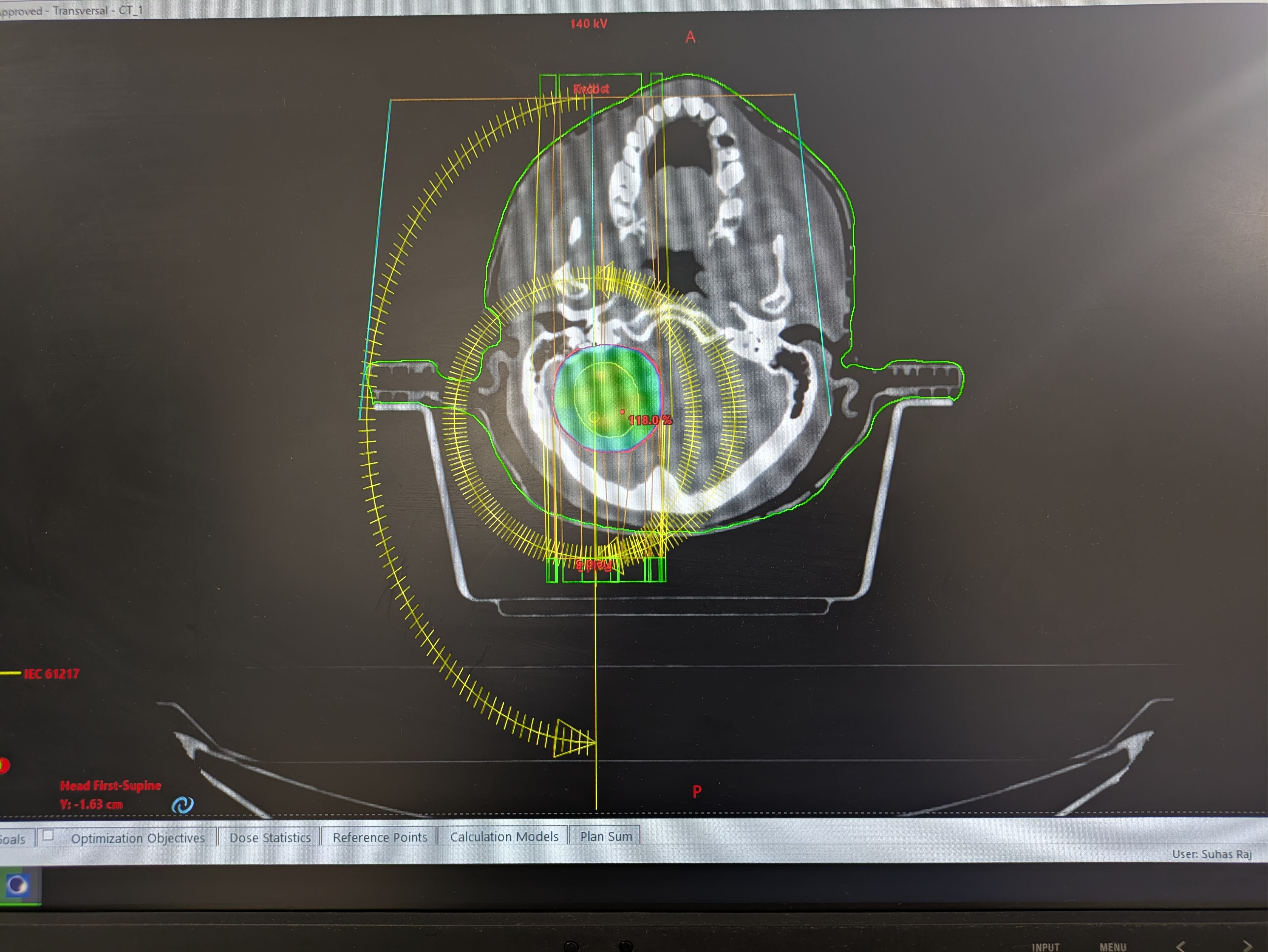 Edge Radiation Therapy System