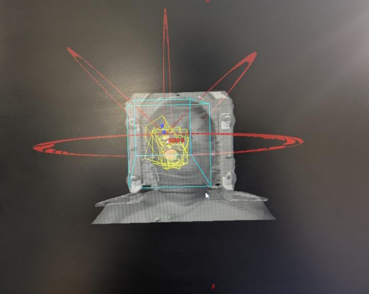Halcyon Radiotherapy Machine